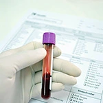 Анализ крови